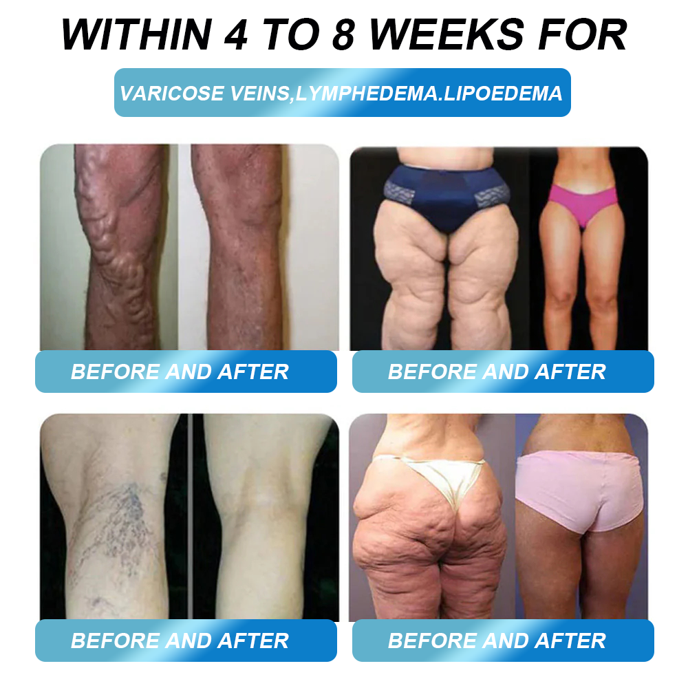 BOOTS Official Flagship Store | DOCTɪA®🌱  Oral ѕ𝑜𝑙𝑢𝑡𝑖𝑜𝑛 👩‍⚕️ Exclusively NHS-Authorised · Support in Weight Management, Heart Health, Blood Sugar Balance, Sleep Apnea & Joint Care ⚡